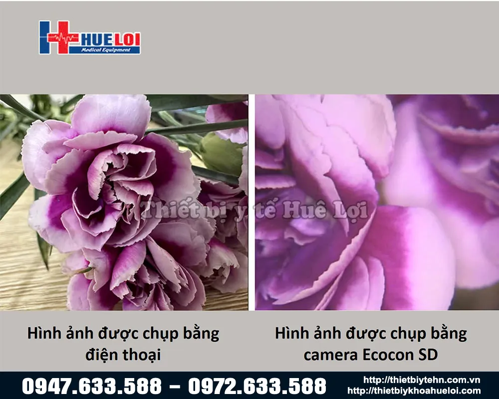 So sánh chất lượng hình ảnh của máy Ecocon SD