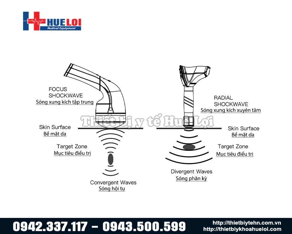 So sánh sóng xung kích hội tụ và phân kỳ