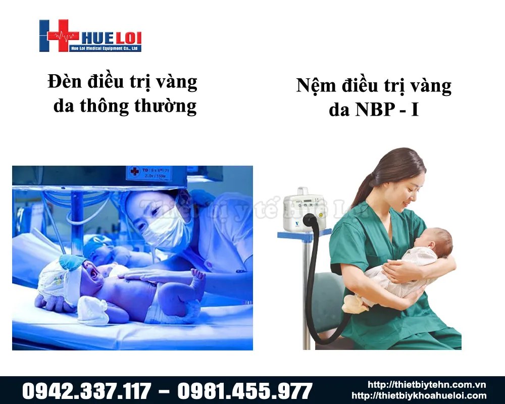 Sự khác nhau trong quá trình điều trị vàng da cho trẻ