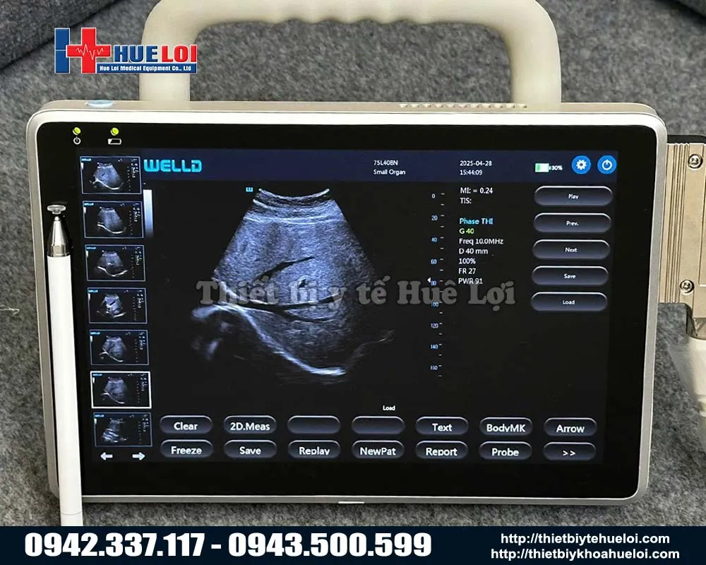 Máy siêu âm hình ảnh không dây - P10
