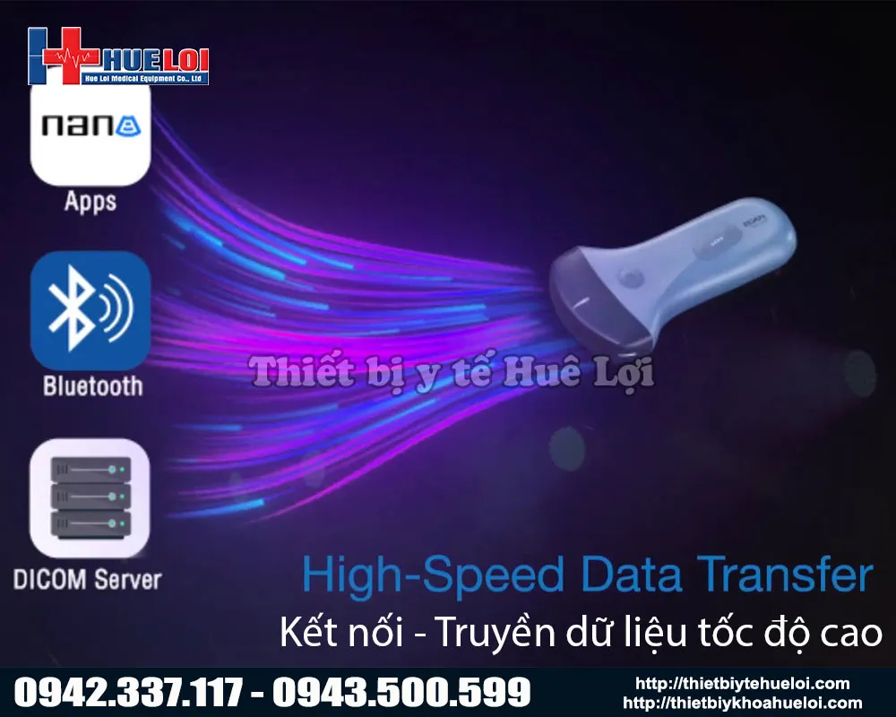 Máy siêu âm hình ảnh di động công nghệ cao
