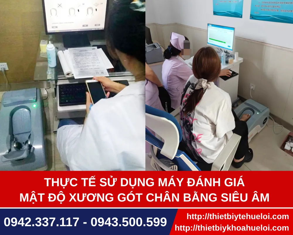 Trải nghiệm thực tế máy đo loãng xương gót chân bằng sóng siêu âm