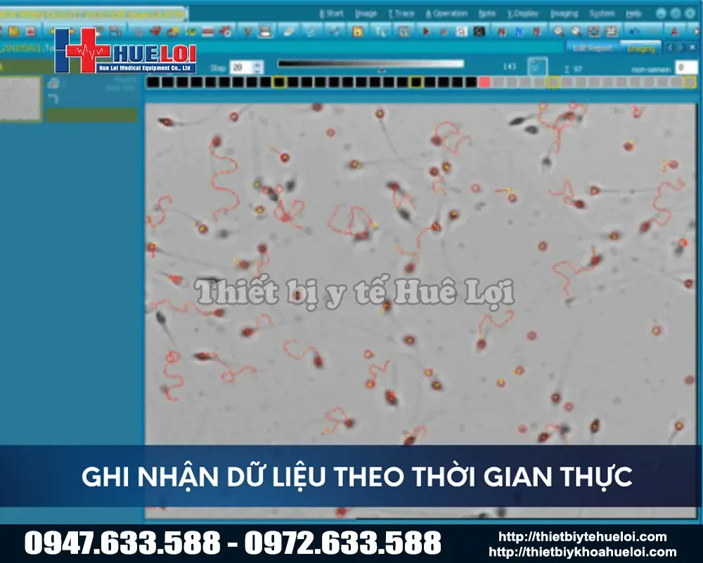 Hình ảnh thực tế của máy phân tích tinh dịch đồ