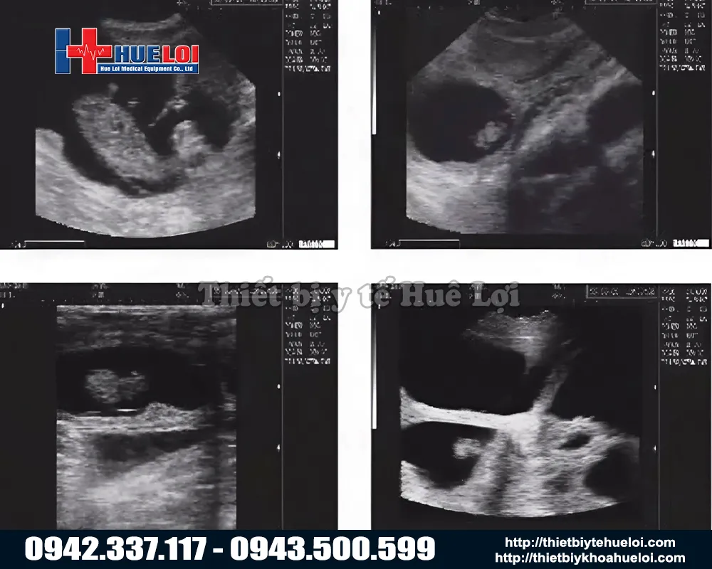 Chất lượng hình ảnh của máy siêu âm cho lợn