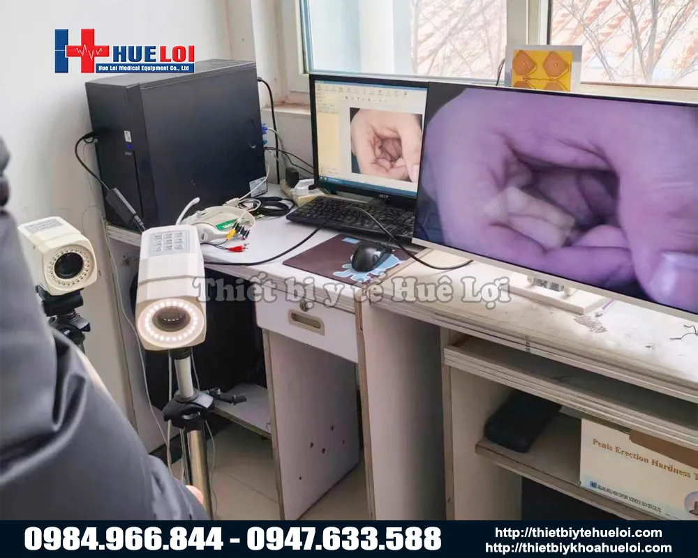 Kết nối máy soi cổ tử cung với máy tính và màn hình cùng 1 lúc