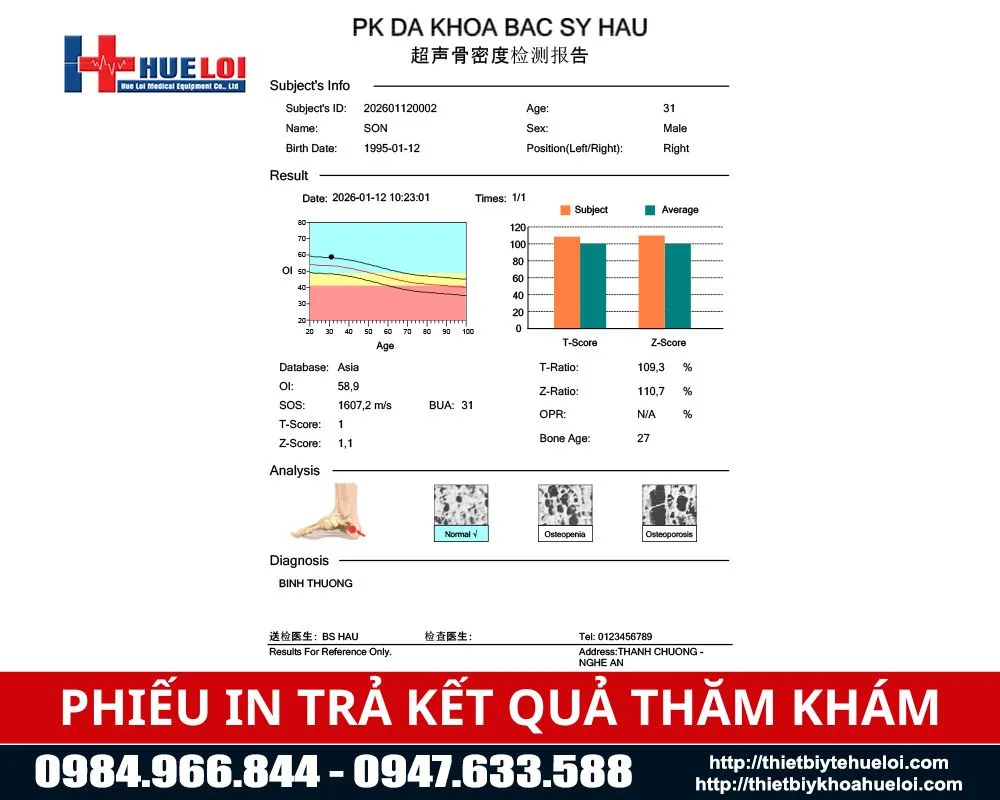Phiếu trả kết quả của m&aacute;y đo lo&atilde;ng xương g&oacute;t ch&acirc;n