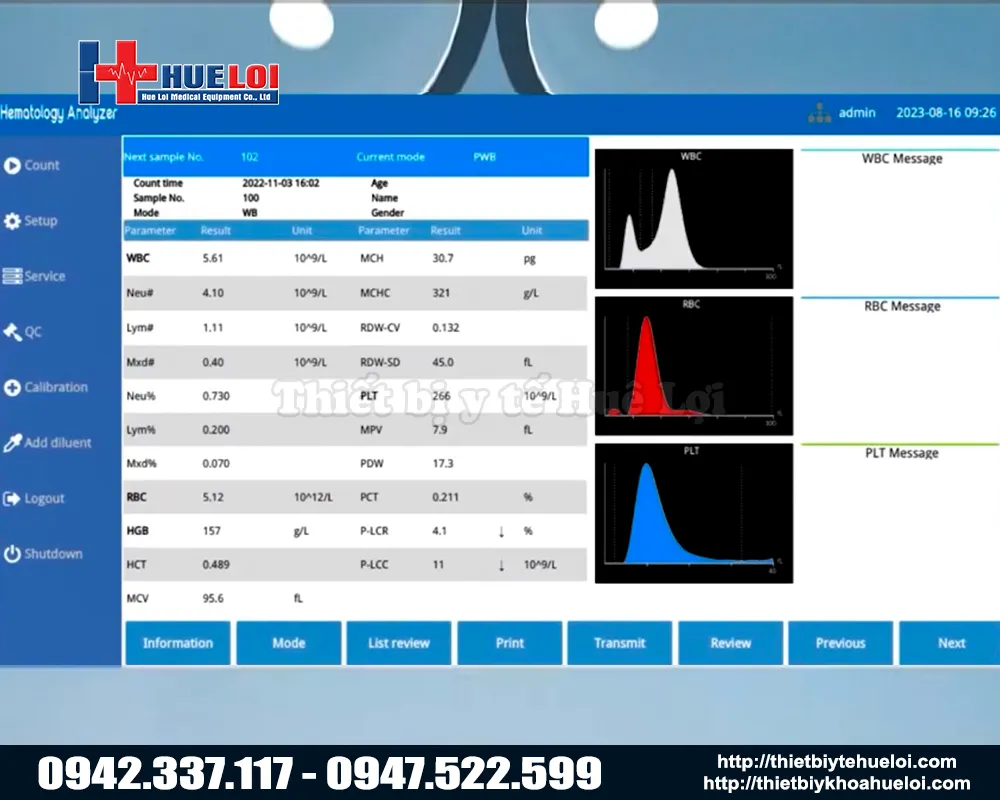 bảng kết quả x&eacute;t nghiệm m&aacute;u th&uacute; y tự động