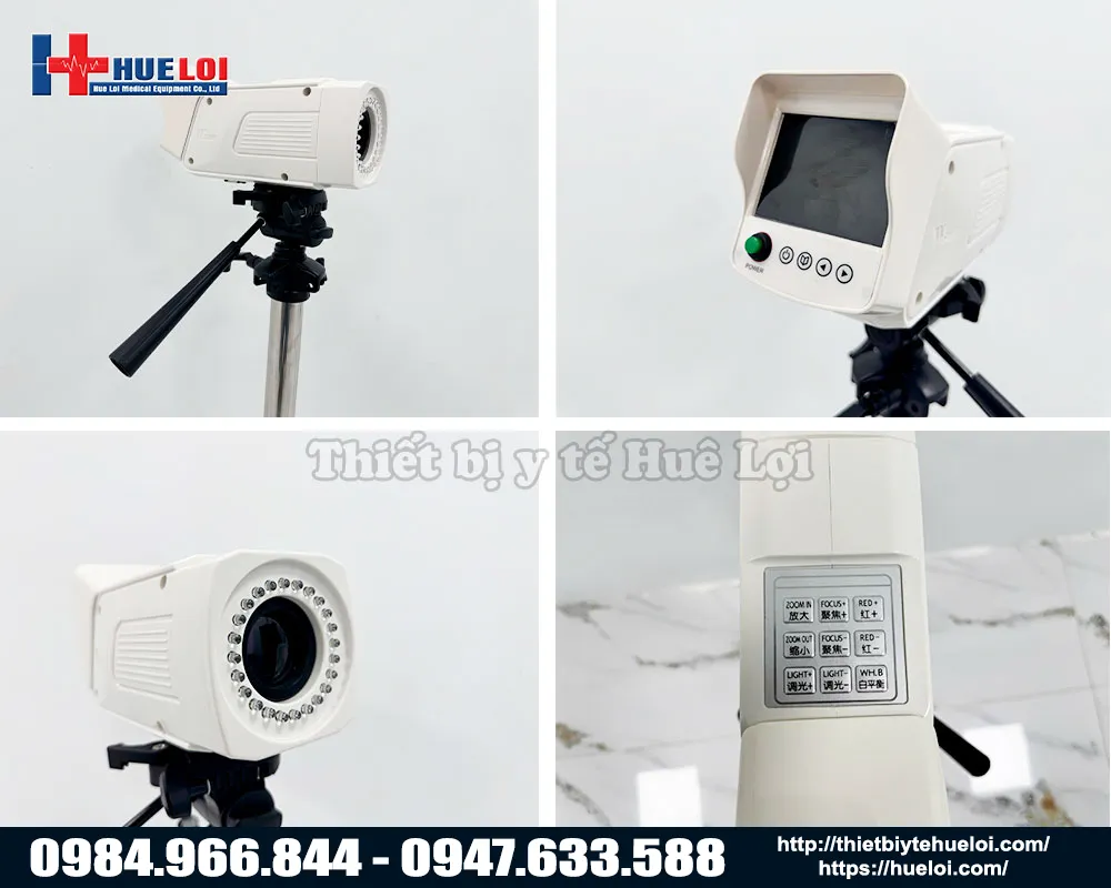 M&aacute;y soi cổ tử cung c&oacute; m&agrave;n h&igrave;nh sau sanwe sw304