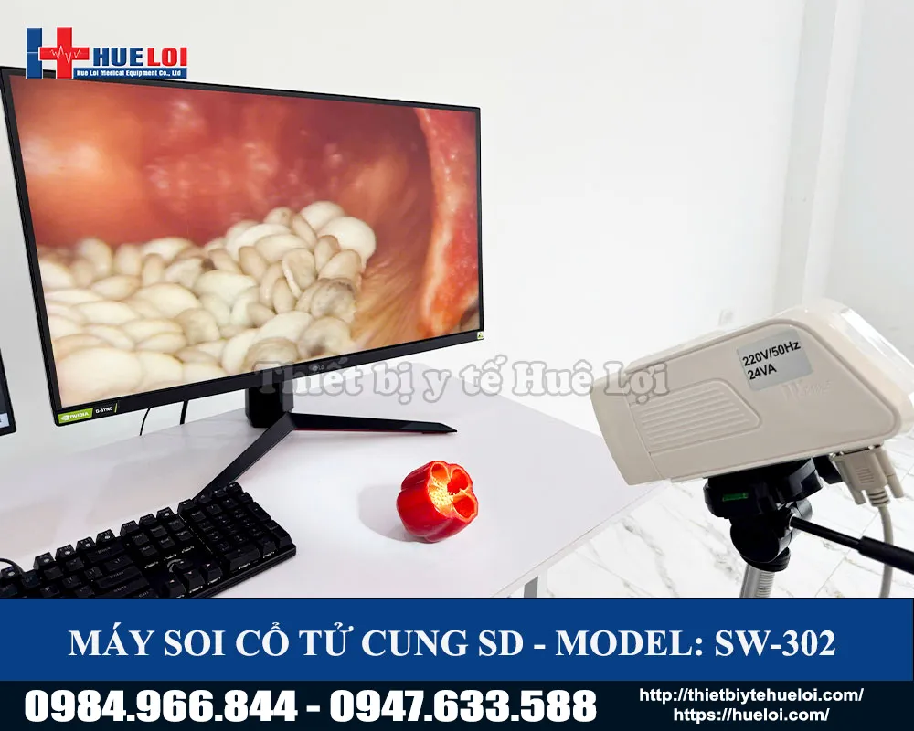 H&igrave;nh ảnh của m&aacute;y soi cổ tử cung sw302