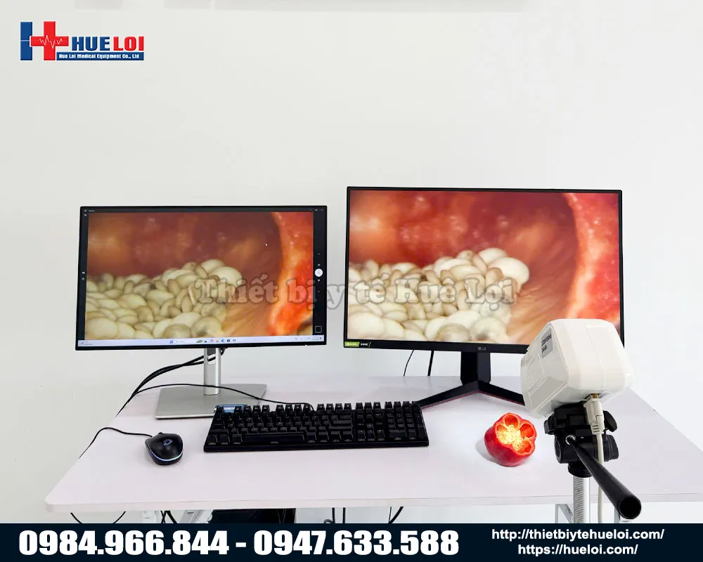 Chất lượng h&igrave;nh ảnh của m&aacute;y soi cổ tử cung sw302