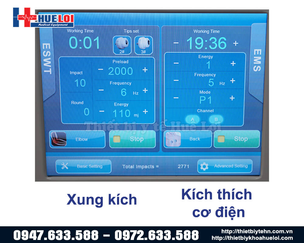 2 chức năng xung kích thước và cơ sở kích hoạt